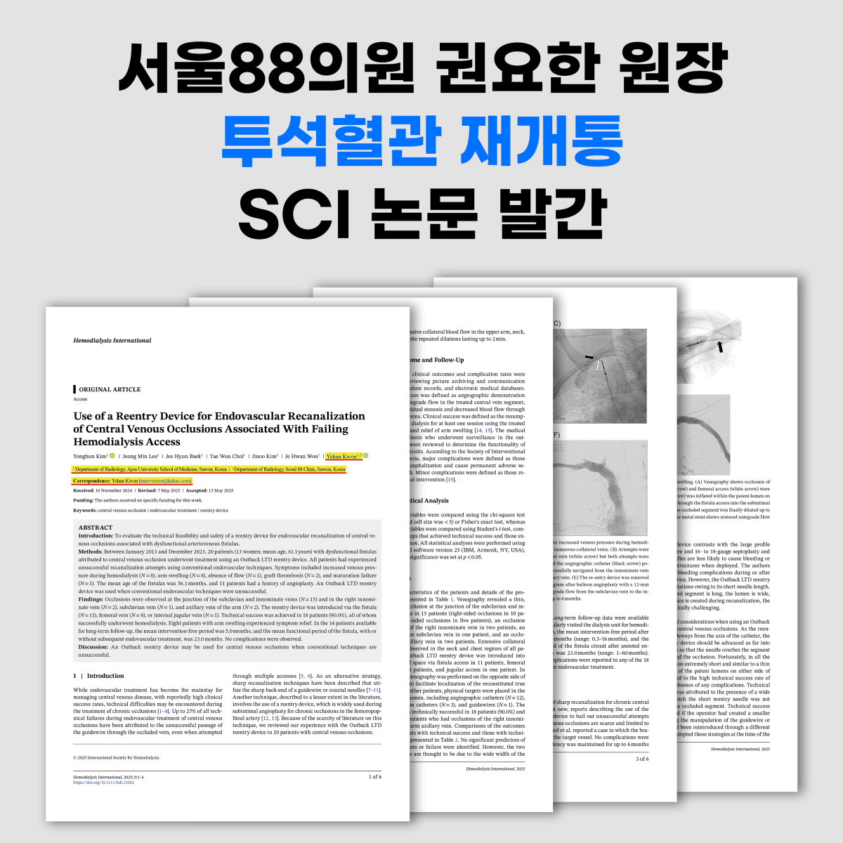 투석혈관 재개통 SCI 논문 등재 (서울88의원 권요한원장)